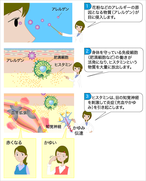 ちあき眼科 各務原 眼の病気について