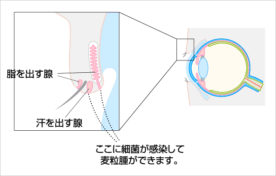 ちあき眼科 笠松 眼の病気について