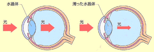 ちあき眼科 各務原 眼の病気について