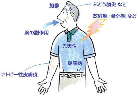 ちあき眼科 岐阜 眼の病気について