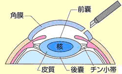 ちあき眼科 岐阜 眼の病気について