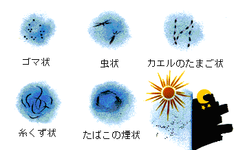 ちあき眼科 笠松 眼の病気について