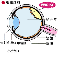 ちあき眼科 岐阜 眼の病気について