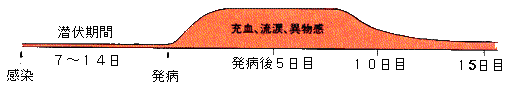 ちあき眼科 各務原 眼の病気について